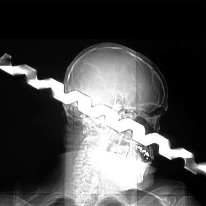 Opal Hours (18/06/2024)